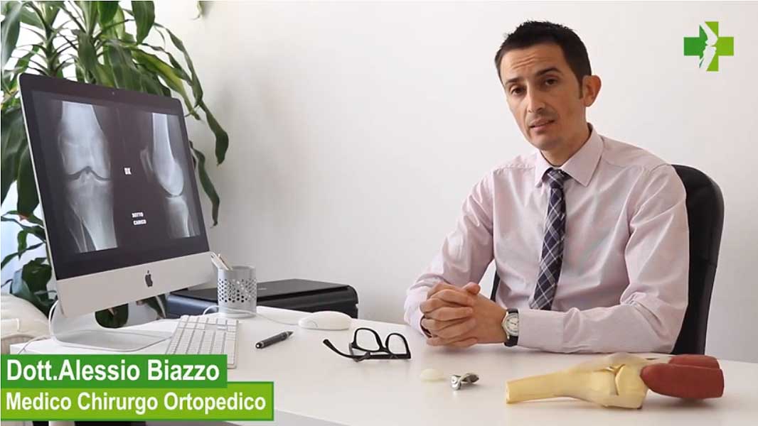 Dr. Alessio Biazzo Medico Chirurgo Ortopedico parla in questo video della protesi femororotulea