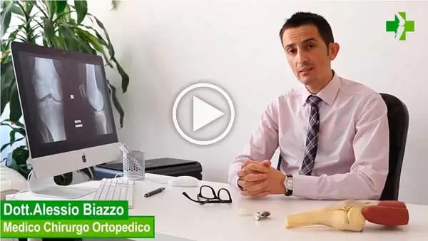 Protesi femororotulea video di presentazione del Dott. Alessio Biazzo