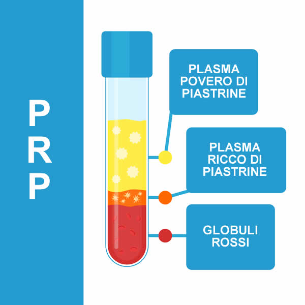 PRP - plasma ricco di piastrine
